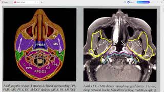 RADIOLOGY EXAM CASES [upl. by Elisa]