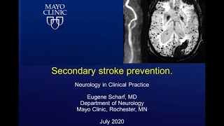 Secondary Stroke Prevention by Eugene Scharf MD  Preview [upl. by Bale]