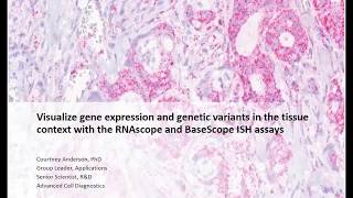 Genetic Variant Detection in Cancer Using ISH to Track Tumor Evolution [upl. by Friede]