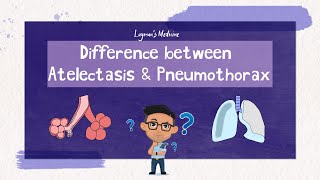 Atelectasis vs Pneumothorax atelectasis pneumothorax [upl. by Nepets]