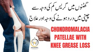 Best Exercise for Chondromalacia Patella  Jumpers Knee  Runners Knee Pain  Patellar Tendinitis [upl. by Ysied]