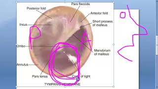 ENT 003 a Tympanic Membrane Anatomy Ear Drum What is Pars Tensa Flaccida Shrapnell annulus umbo Part [upl. by Sivia871]