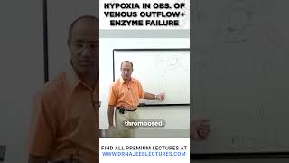 Hypoxia in Obs of venous outflow  Enzyme failure drnajeeb drnajeeblectures shortvideo [upl. by Alesram]