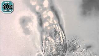 A Bdelloid Rotifer [upl. by Ahsad]