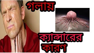 গলার ক্যান্সারের এইসব লক্ষণ অবহেলা করবেন না ভুলেও [upl. by Rinum]