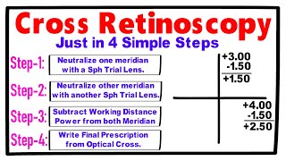 Cross Retinoscopy just in 4 Simple Steps [upl. by Pascoe]