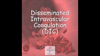 Part 3 Disseminated Intravascular Coagulation DIC [upl. by Hazaki3]