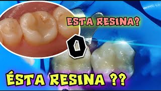 CUAL RESINA O EMPASTE de COMPOSITE ES MEJOR [upl. by Arlyn]