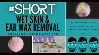 WET SKIN amp EAR WAX REMOVAL [upl. by Bendite732]