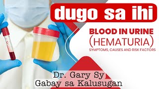 Hematuria Blood In Urine  Dr Gary Sy [upl. by Eerual328]