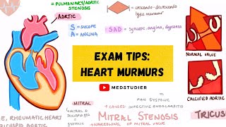 How to remember heart murmurs  Mnemonics Diagrams amp More  MedStudier [upl. by Ennovyhs]