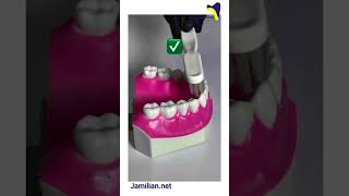 Effective Tooth Brushing Techniquesorthodontics dentist orthodontistbrushing toothpaste brush [upl. by Custer]