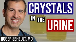 Review of Crystals Found in the Urine for Kidney Stones [upl. by Ahcilef]