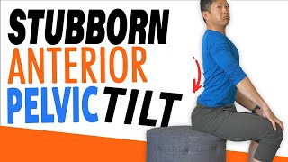 The Simple Fix for Anterior Pelvic Tilt [upl. by Dace]