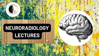 Trigeminal neuralgia  Dr Ahmed ElAgamy [upl. by Nelag]