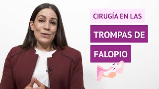 ¿La cirugía soluciona los problemas en las trompas de Falopio [upl. by Nybbor]