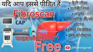 FIBROSCAN OF LIVER  फाइब्रोस्कैन kaise hota hai dheko फाइब्रोस्कैन क्या है  tranding shortvideo [upl. by Rehpotsihc]