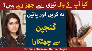 Balon Ko Girnay Se Roknay ka Asan Tareeqa  Easy Hair Loss Treatment At Home In UrduHindi [upl. by Cristina881]