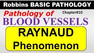 Ch10  RAYNAUD PHENOMENA  Blood Vessel Pathology  Robbins Lectures [upl. by Eca163]