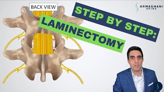 Step by step how to perform a lumbar laminectomy [upl. by Janna445]