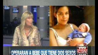 C5N  SALUD OPERAN A BEBE QUE TIENE DOS SEXOS [upl. by Naols690]