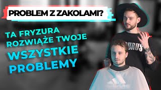 Duże zakola Największa zmora mężczyzn [upl. by Yauq]