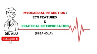 Myocardial Infarction ECG Features amp Practical Interpretation Acute Coronary Syndrom Angina ECG [upl. by Gwenny374]