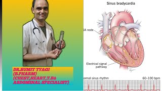 SINUS ARRTHMIA BRADICARDIA amp TRACHECARDIA BY DRSUMIT TYAGISUMITMEDICALDISPENSARY1 [upl. by Mcnully97]