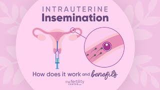 Intrauterine Insemination How Does It Work amp Benefits  The Fertility Center [upl. by Neirrad517]