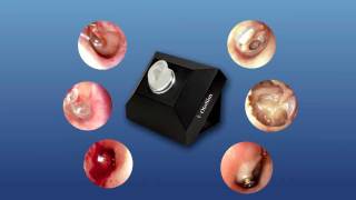 OtoSim™ Otoscopy Training amp Simulation  Intro [upl. by Garrett899]