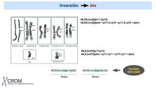 Nomenclatura para las anomalías cromosómicas estructurales [upl. by Crissy613]