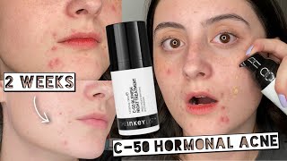 BEST ACNE TREATMENT The Inkey List C50 Blemish Night Treatment 2 Week Test [upl. by Terrance214]