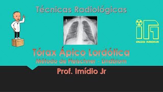 Radiografia do Tórax AP  Ápico Lordótico  método de Fleischner [upl. by Anahcar11]