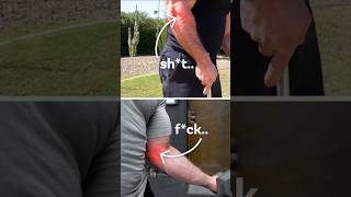 Got Tennis or Golfers Elbow This is How You Fix Them golferselbow tenniselbow elbowpain [upl. by Lomaj]