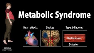 Metabolic Syndrome Animation [upl. by Ardnuasak]