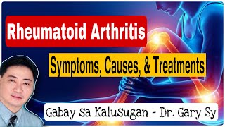 Understanding Rheumatoid Arthritis  Dr Gary Sy [upl. by Atibat23]