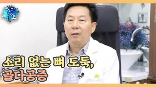 소리 없는 뼈 도둑 골다공증 MBN 240719 방송 [upl. by Dis]