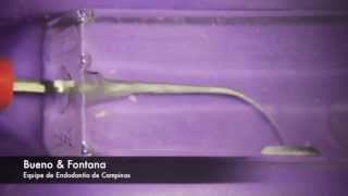 WaveOne Reciprocating System  Sistema Recíproco WaveOne  Equipe de Endodontia de Campinas [upl. by Peirsen124]