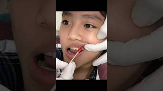 baby tooth extraction [upl. by Grania557]