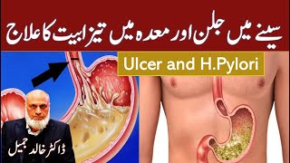 Stomach Ulcer and Acid Reflux  Lecture 198 [upl. by Calandria989]