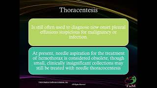 Hemothorax review [upl. by Namyaw961]