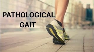 10 PATHOLOGICAL GAIT  Symptoms  causes and gait deviation analysis bhpiposchool [upl. by Lehcnom992]