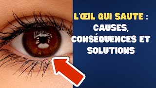 L’œil qui saute  causes conséquences et solutions Fact24h [upl. by Ardnuyek]