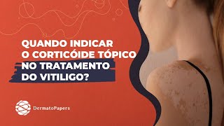 Corticóides tópicos muito indicados para os casos de vitiligo localizado [upl. by Aneelad]