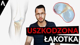 Uszkodzona Łąkotka Pęknięta  Co warto o niej wiedzieć [upl. by Nared]