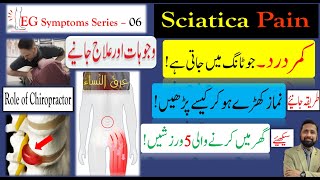 Sciatica Low back Pain عرق النساء  کمر درد  Dr Ali Hassan [upl. by Sussi]