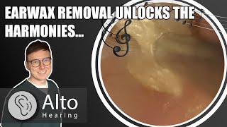 From Muffled to Melodic Earwax Removal Restores Singers Hearing [upl. by Ariamat]