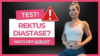 SO testest du deine REKTUSDIASTASE  Rückbildung  Beckenboden  Flacher Bauch [upl. by Kcyrred]