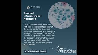 Understanding Cervical Intraepithelial Neoplasia CIN [upl. by Alaehs744]