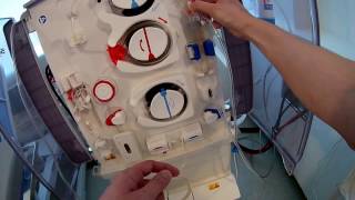 How to setup dialysis fresenius 5008 machine Frenchdialyse [upl. by Morton]